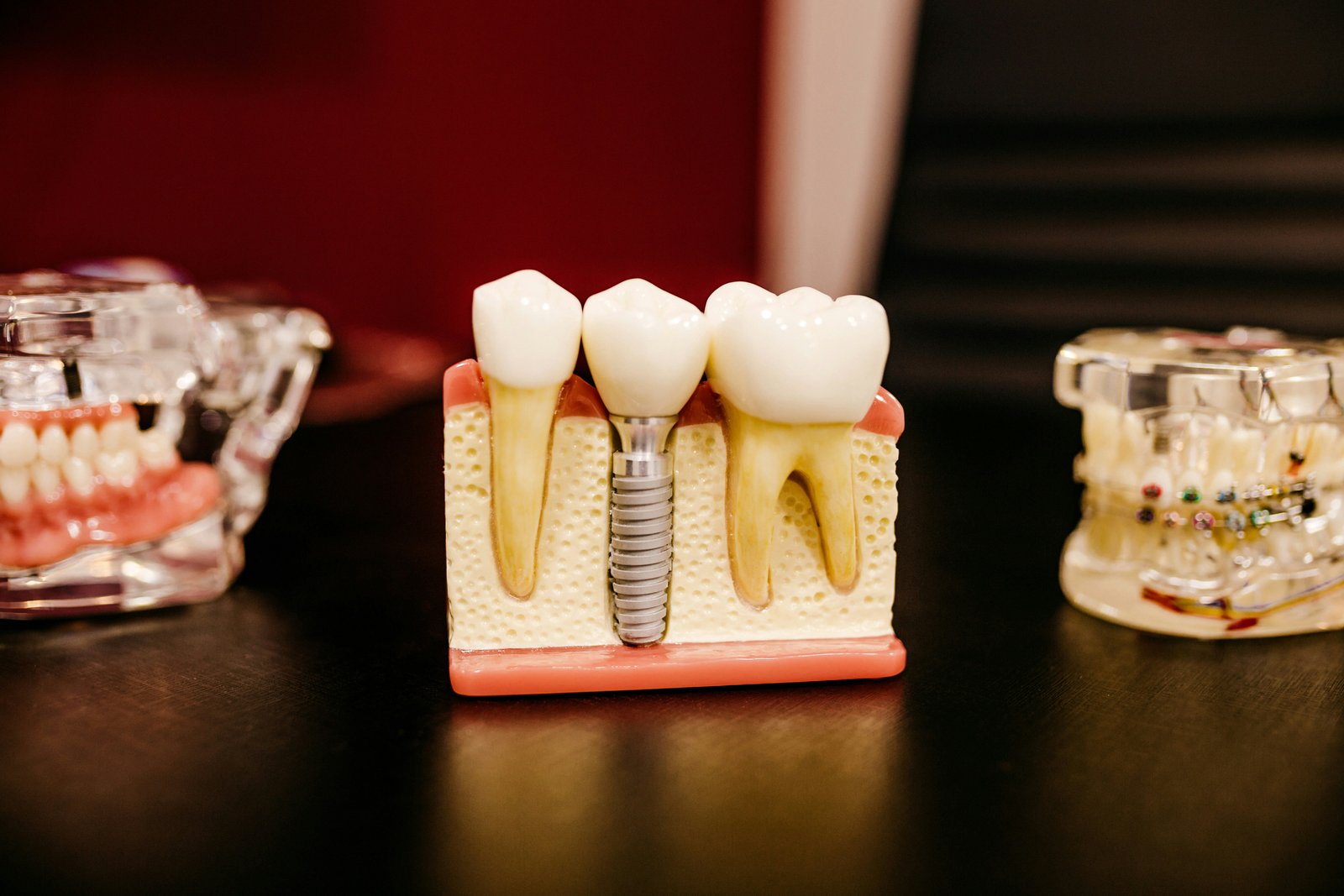 Does Insurance Cover Emergency Dental Visits in Fort Worth?